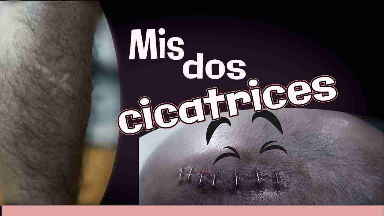 Devocional Mis dos cicatrices